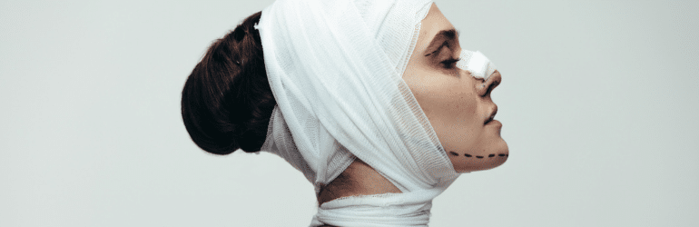 Side view of woman wrapped in bandages after anti aging and face life surgery.